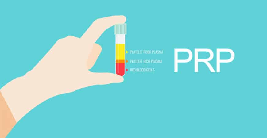 Platelet Rich Plasma