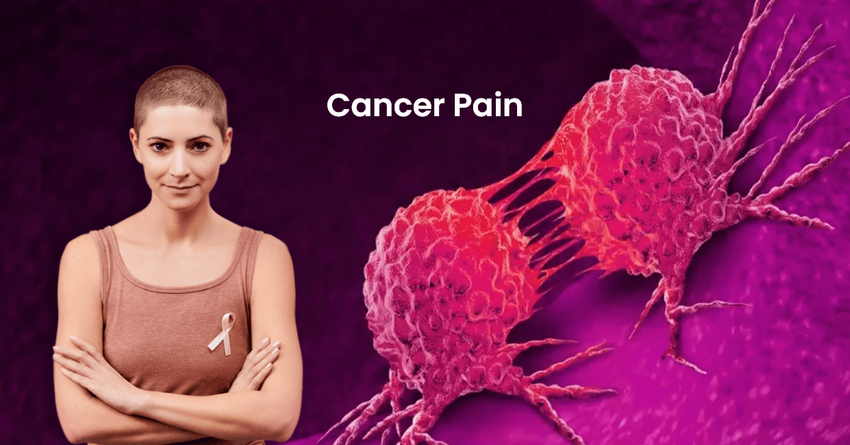 Cancer Pain Treatment