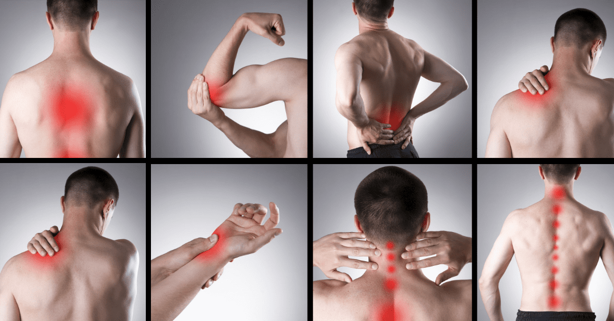 Complex Regional Pain Syndrome