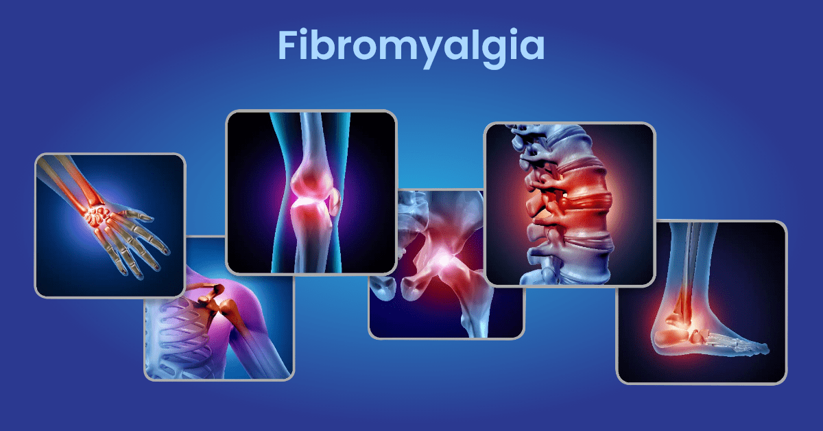 Fibromyalgia