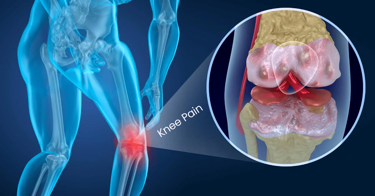 Knee Pain Treatment