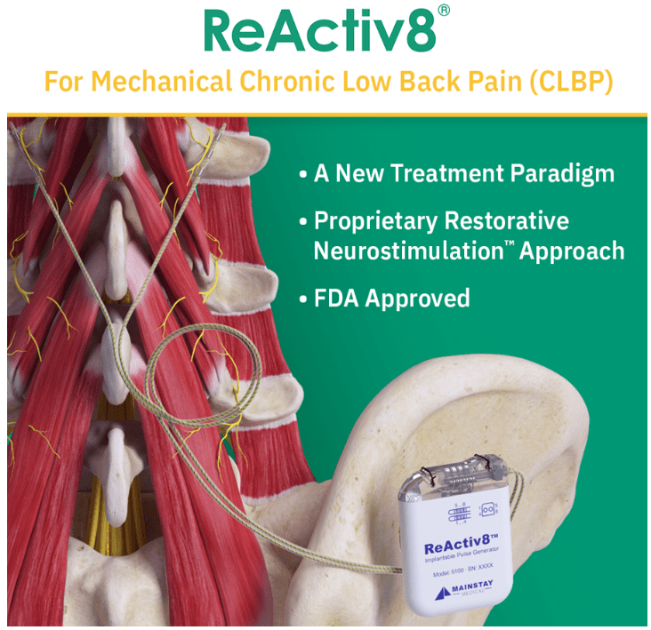 ReActiv8 Procedure