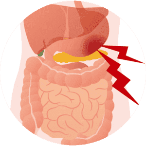 Chronic Abdominal Pain