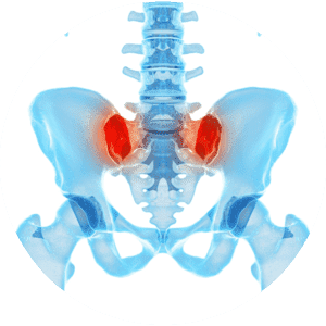 Chronic Pelvic Pain